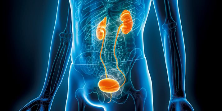 Perioperative Therapie des muskelinvasiven Blasenkarzinoms